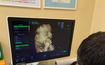 RUŽOMBEROK: Ústredná vojenská nemocnica zakúpila nový 3D/4D ultrazvuk